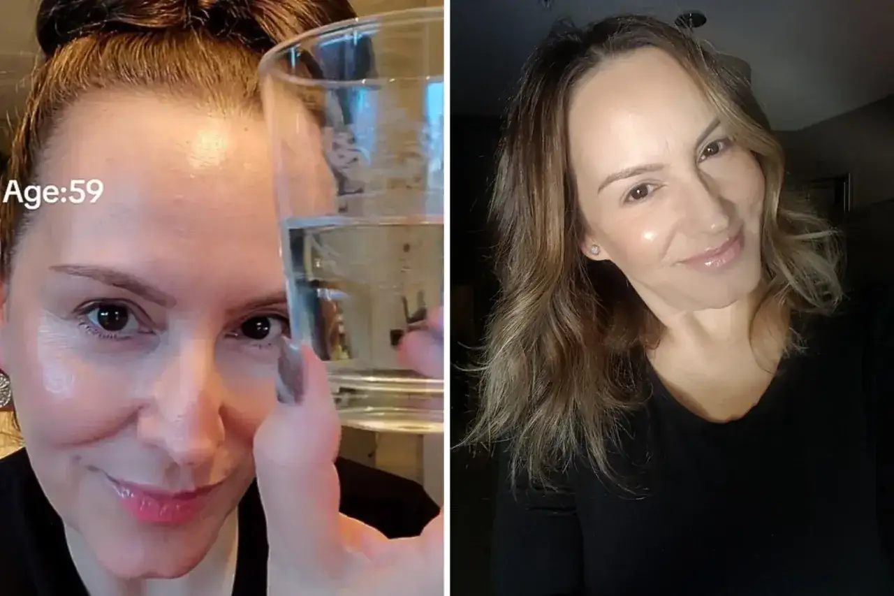 Kvinna, 59, visar hur man kan f&aring; bort bekymmersrynka utan botox genom att dricka vatten.