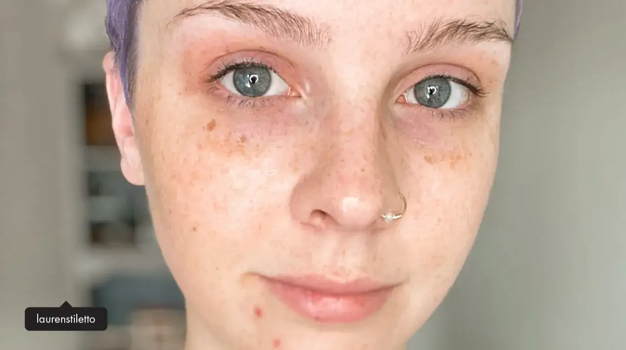 Närbild på en person med blågröna ögon, fräknar och en näsring. Huden har naturlig melanin och några små finnar.